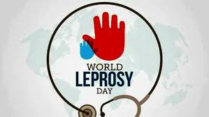 31 Janeiro – dia mundial da lepra